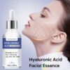 30ml/50ml Pure Hyaluronic Acid Face Serum, With Plant Squalane, Refreshing And Non-Greasy Facial Essence, Enhances Hydration Of Dry Skin, Nourishes Dry And Rough Skin - Image 5