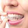 [:en]Silicone Teeth Trays for Teeth Whitening Transparent 1Pc/2Pcs Dental Tray Mouth Teeth Whitening Trays Mouth Guard Tooth Tool[:ar]Silicone Teeth Trays for Teeth Whitening Transparent 1Pc/2Pcs Dental Tray Mouth Teeth Whitening Trays Mouth Guard Tooth Tool[:] - Image 2
