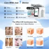 Multifunctional 7 in 1 Diamond Peeling Water Jet Aqua Facial Hydra Dermabrasion RF Oxygen Diamond Peeling Machine - Image 6