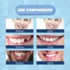10g/bag Tooth Repair Kit-thermal Beads For Filling Fix The Missing And Broken Tooth Or Adhesive The Denture Fake Teeth Gutta Per - Image 6