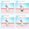 Newest Peeling Beauty Device Hydra Dermabrasion Aqua Facial Cleaning Small Bubble Oxygen Injection Instrument Suction Blackhead - Image 6