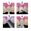 1 Set Dental Veneer Mould Kit Composite Resin Mold Light Cure Autoclave Anterior Front Teeth Mould Teeth Whitening Tools - Image 6
